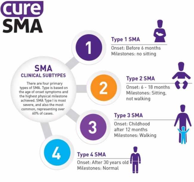 SMA-types-e1536103644514