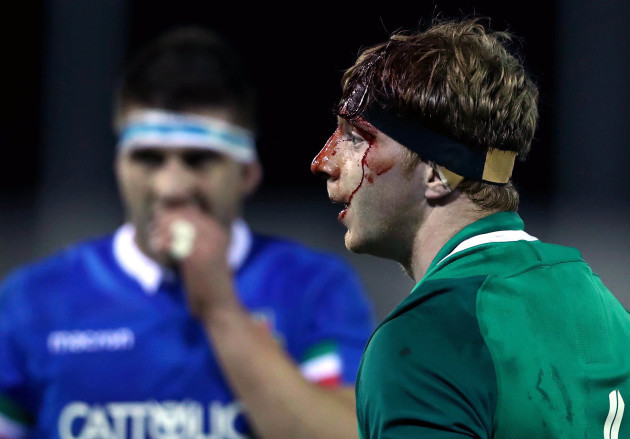 Martin Moloney bloodied during the game