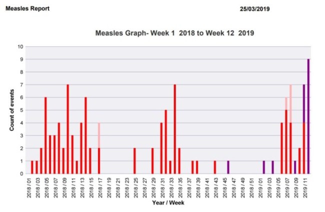 measles