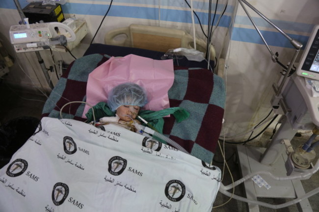 Injured children in Syria