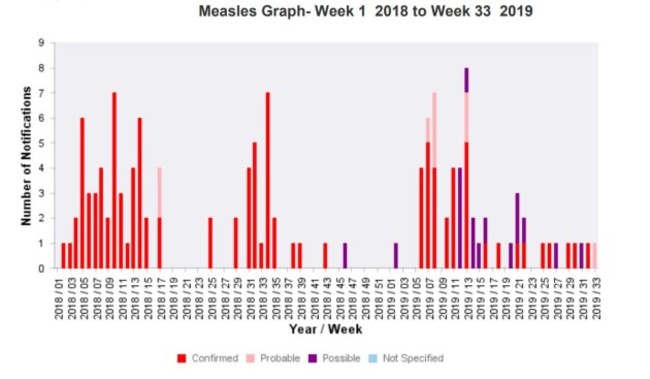 measles