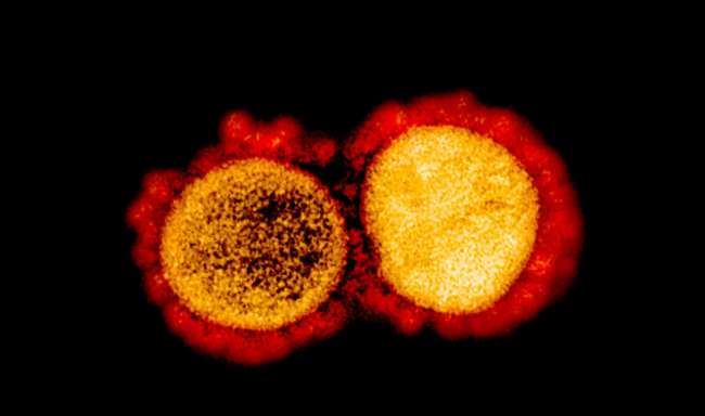 Coronavirus11