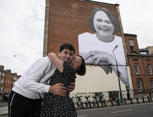 down-syndrome-ireland-the-upside-campaign