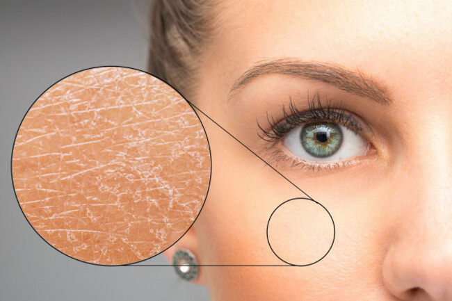 amagnifiedmacrodetailedcircleisseenoverthecheek