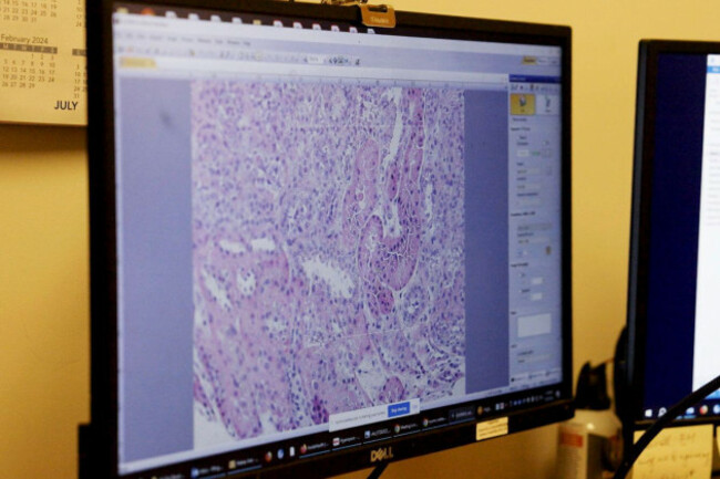 researchers-at-nyu-langone-health-examine-cells-from-a-pig-kidney-biopsy-after-the-transplant-of-the-pigs-kidney-into-a-brain-dead-man-in-new-york-on-july-28-2023-researchers-around-the-country-are