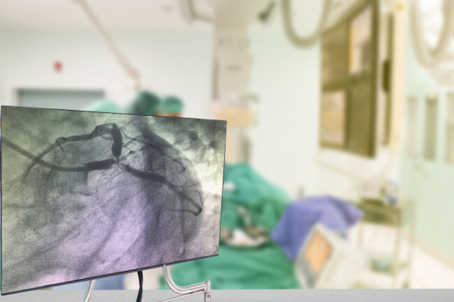 cardiaccatheterizationwithcoronaryangiographyonblurrycardiaccatherizationlab