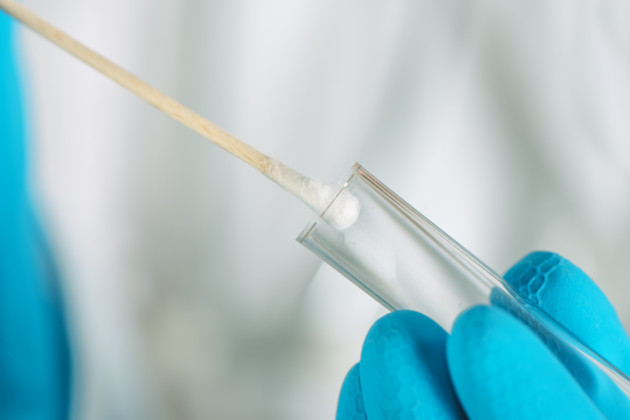 棉签DNA测试管宏观图像医疗