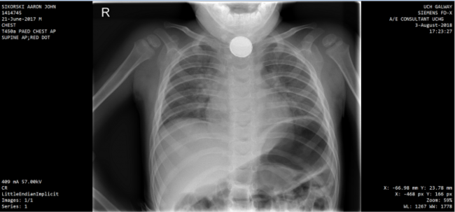 SIK2 - Image - Galway UH 03Aug2018