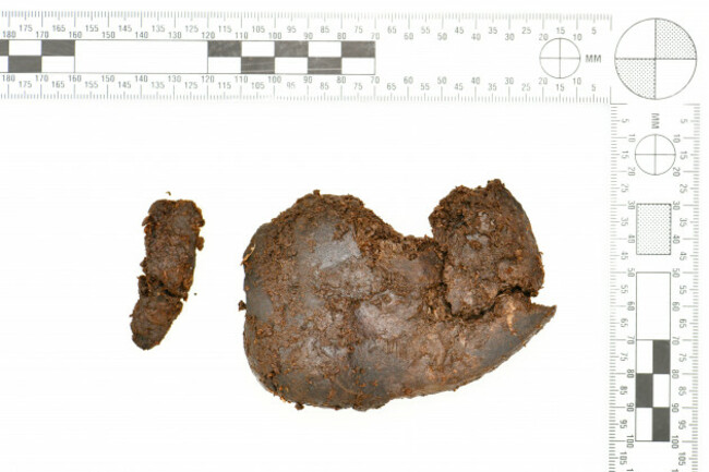 Image 5 - kidney