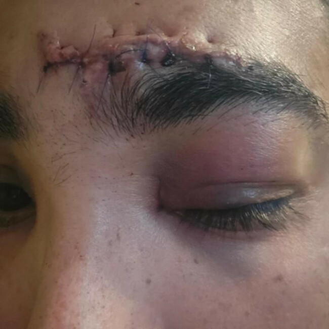 Roberto Gomes dos Santos Jnr CAPTIONED 5