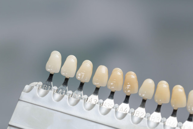 close-up-of-a-shade-guide-to-check-veneer-of-tooth-crown-or-implant-in-dental-laboratory