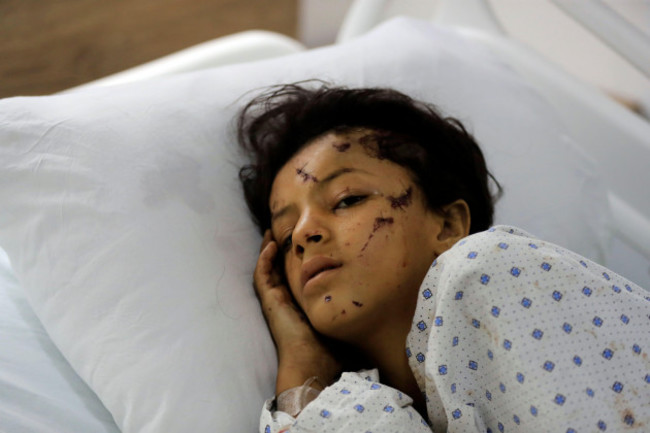 a-wounded-girl-lies-in-a-hospital-bed-in-the-southern-village-of-saksakieh-lebanon-tuesday-sept-24-2024-ap-photomohammed-zaatari