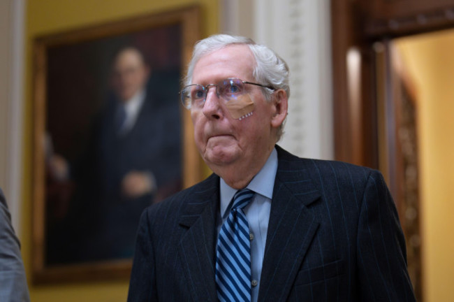 senate-minority-leader-mitch-mcconnell-r-ky-is-seen-with-a-bandaged-face-and-wrist-brace-following-a-stumble-and-fall-earlier-at-lunch-at-the-capitol-in-washington-tuesday-dec-10-2024-ap-pho