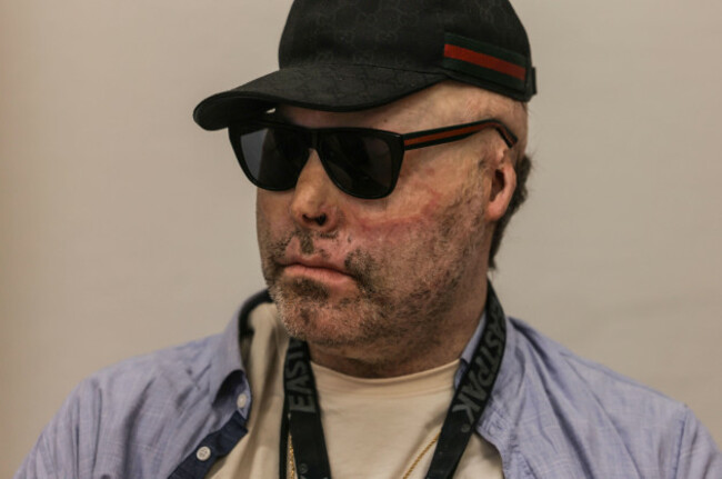 cologne-germany-18th-jan-2024-the-accused-dr-knarf-niko-brenner-is-sitting-in-the-district-court-together-with-another-defendant-the-rapper-is-alleged-to-have-produced-butane-hash-oil-in-an-a