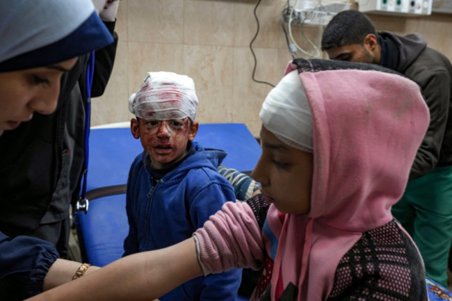 palestinian-children-wounded-during-the-israeli-bombardment-of-the-gaza-strip-receive-treatment-at-the-al-aqsa-hospital-in-deir-al-balah-tuesday-jan-14-2025-ap-photoabdel-kareem-hana