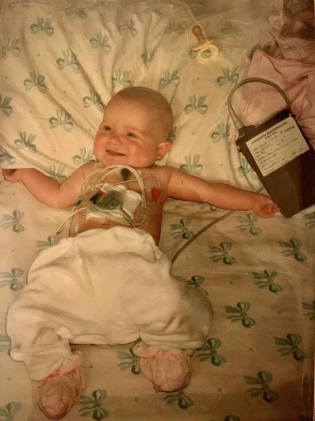 7. Grace Davitt at home with a Holter monitor, around age six months