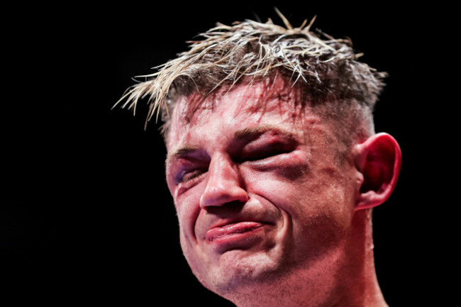 kevin-cronin-dejected-after-the-fight