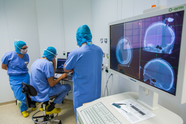 surgical-treatment-of-parkinsons-disease-by-deep-brain-stimulation-with-rosa-robot-amiens-hospital-france