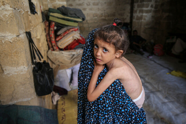 gaza-city-gaza-city-11th-may-2025-a-palestinian-mother-and-her-6-year-old-daughter-who-is-suffering-from-malnutrition-are-seen-at-a-temporary-shelter-in-east-of-gaza-city-on-may-11-2025-pales