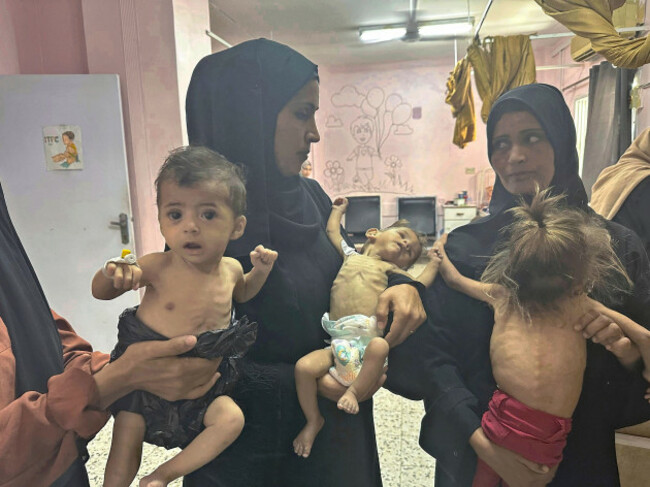 mothers-hold-their-emaciated-children-at-nasser-hospital-in-khan-yunis-gaza-palestine-on-july-21-2025-the-many-gaza-residents-especially-children-and-elders-have-collapsed-from-famine-and-malnu