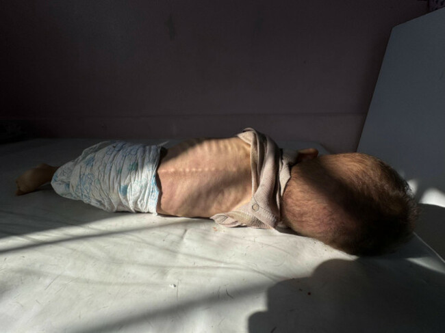 palestinian-toddler-mohammad-zakaria-asfour-16-months-old-lost-his-life-at-nasser-medical-complex-palestinian-toddler-mohammad-zakaria-asfour-16-months-old-lost-his-life-at-nasser-medical-complex-in-k