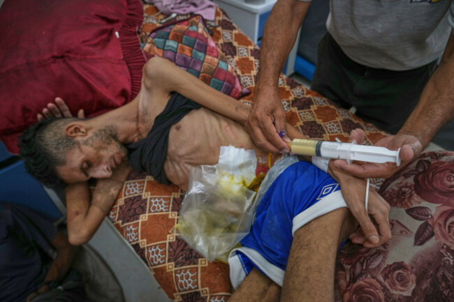 atef-arhouma-feeds-his-injured-son-karam-arhouma-22-lentil-soup-through-a-syringe-at-shifa-hospital-where-doctors-say-he-is-showing-signs-of-malnutrition-in-gaza-city-monday-aug-18-2025-ap