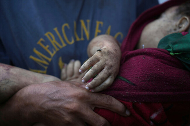 alaa-hassanein-carries-the-body-of-his-4-year-old-niece-sara-hassanein-who-was-killed-in-an-israeli-military-strike-on-a-school-used-as-a-shelter-outside-al-shifa-hospital-in-gaza-city-friday-au
