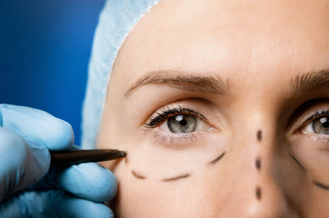 surgeon-preparing-womans-face-for-plastic-surgery-facelift-procedure