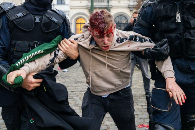 police-carry-away-a-man-who-was-injured-in-clashes-during-a-demonstration-of-european-farmers-near-the-european-parliament-in-brussels-thursday-dec-18-2025-ap-photomarius-burgelman