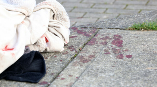 422 Arson Incident Finglas_90740576