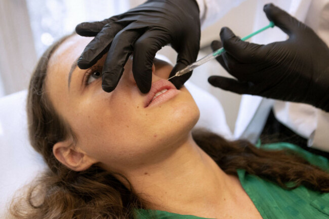 montpellier-france-29th-may-2023-may-29-2023-montpellier-occitanie-france-guillaume-bonnefontip3-montpellier-france-le-29-mai-2023-illustration-chirurgie-esthetique-une-jeune-femme-subit