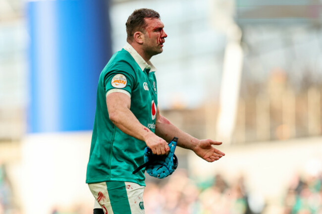 tadhg-beirne-with-a-blood-injury