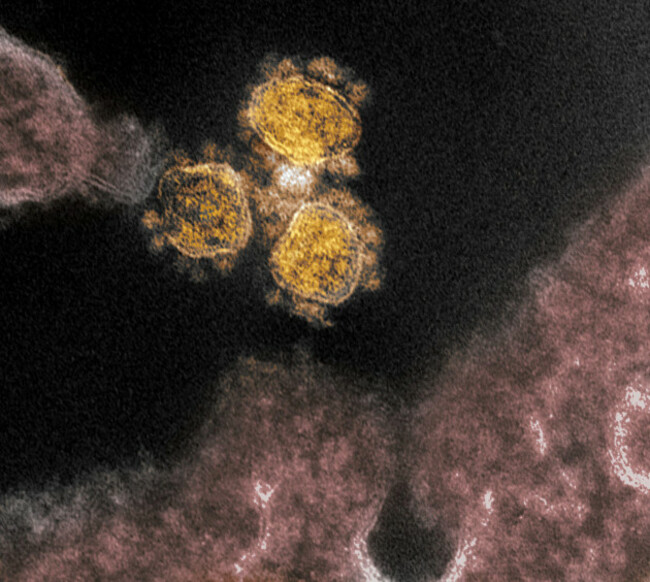 this-transmission-electron-microscope-image-shows-sars-cov-2-the-virus-that-causes-covid-19-isolated-from-a-patient-in-the-u-s-virus-particles-rou